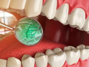 dentista urgencias infección dental sevilla