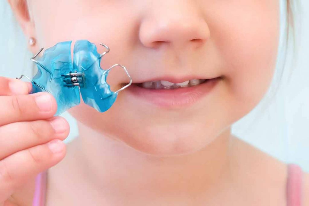 ortodoncia removible para niños sevilla