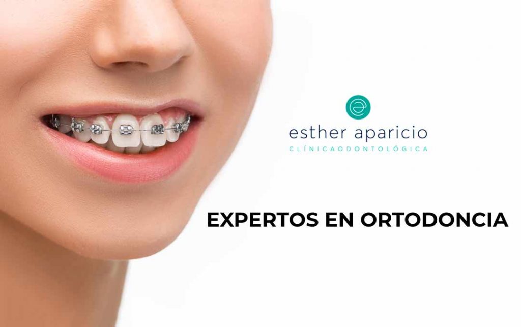 expertos en ortodoncia sevilla