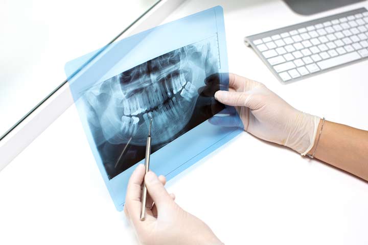 implantologia dental sevilla