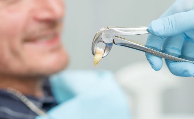 tratamiento extraccion dental sevilla